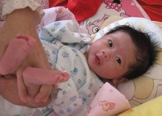 宝宝小腿短注定矮个子吗,小孩腿部有多处又硬又红