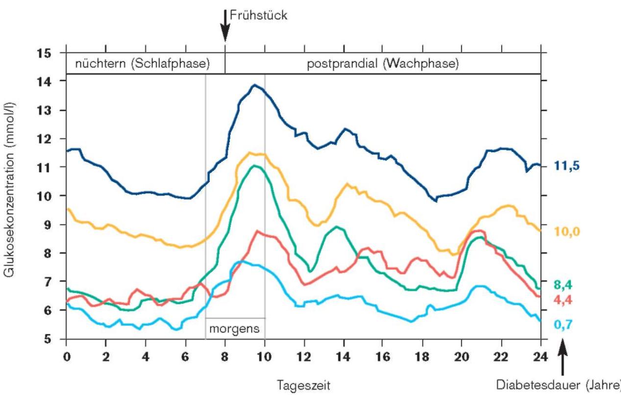 胰岛素泵和打胰岛素针的优缺点,胰岛素泵和注射胰岛素一样吗