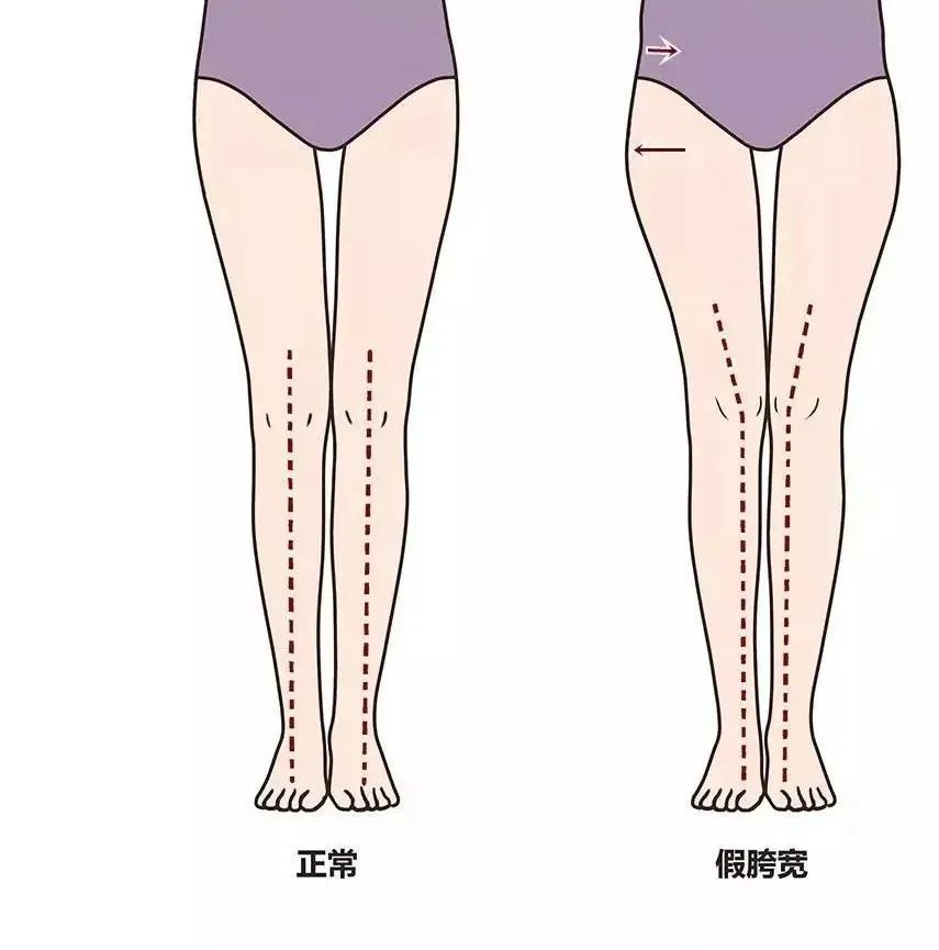 臀腿塑形5个动作拥有迷人臀腿,臀型怎么变假胯宽