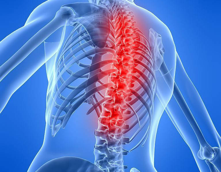 脊柱血管瘤的6个征兆,脊椎小血管瘤有微创手术吗