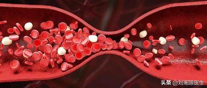 「免疫相关不良妊娠答疑解惑40」——系统性血管炎