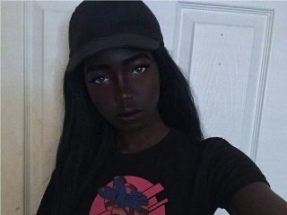 世界上最黑的婴儿眼睛都看不见了,世界上最黑的宝宝现在过的怎么样