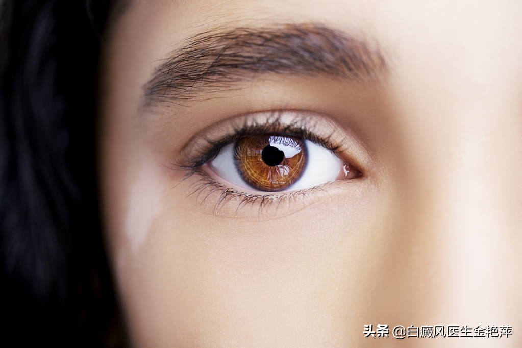 10年内彻底攻克白癜风,十大治疗白癜风药