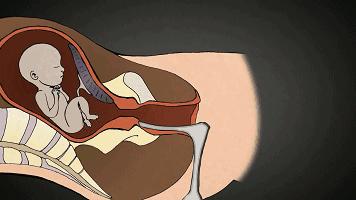 打胎有多可怕案例,20岁女生堕胎7次