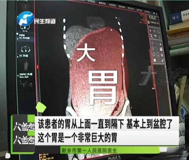 人生少一点感悟,少则得多则惑大道至简