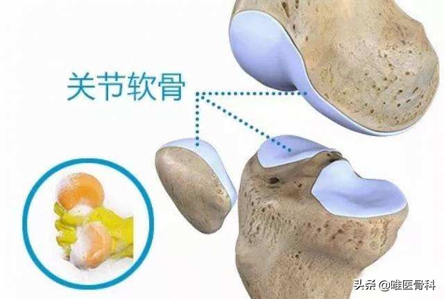 盐酸和硫酸氨基葡萄糖哪个好,盐酸氨基葡萄糖与硫酸葡萄糖区别