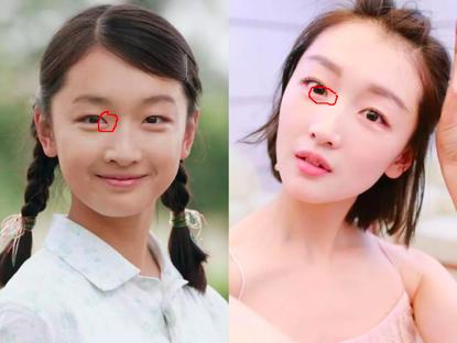 整容怎么整才能整得又自然又美,长脸整容怎样整好看