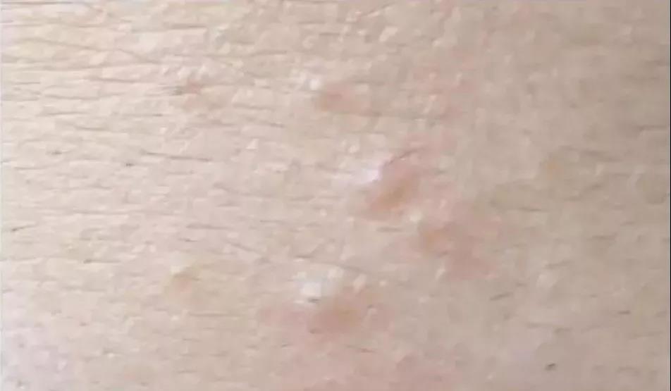 额头有一撮小头发该怎么搞呢,额头有小毛毛怎么长出来