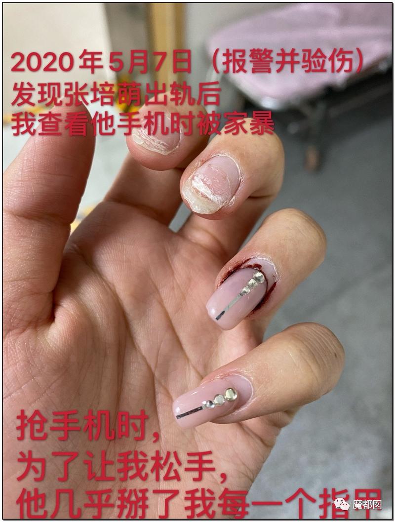 短跑名将张培萌被曝家暴,短跑名将张培萌殴打岳母被行拘