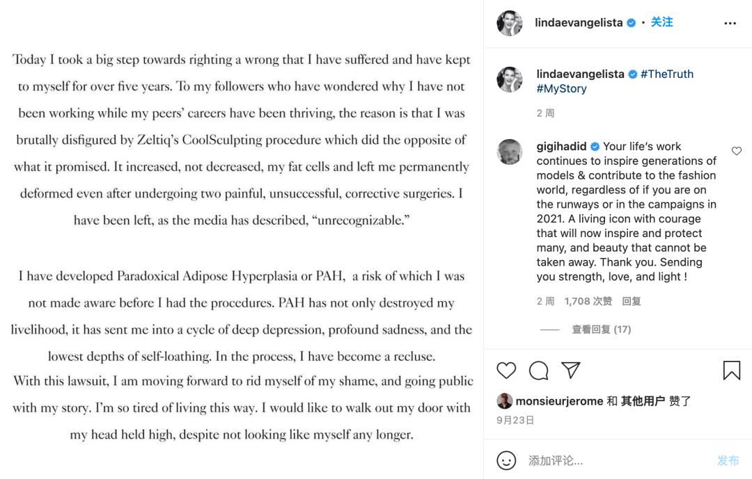 那个曾经没有10000美金不起床的超模,被医美毁容了