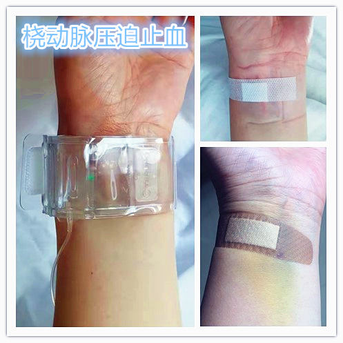 子宫肌瘤不能开刀只能化疗严重吗,子宫肌瘤介入栓塞治疗后注意事项