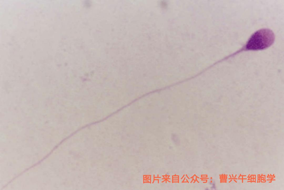 男科诊疗纪实,男科专家谈精子系列