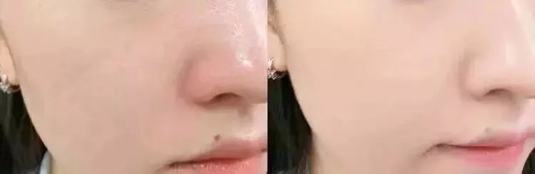 用过最好用的干皮粉底液,最好用的几款粉底液