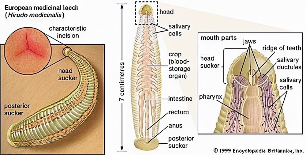 蚂蟥吃进肚子会繁殖吗,蚂蟥吃进胃里的后果