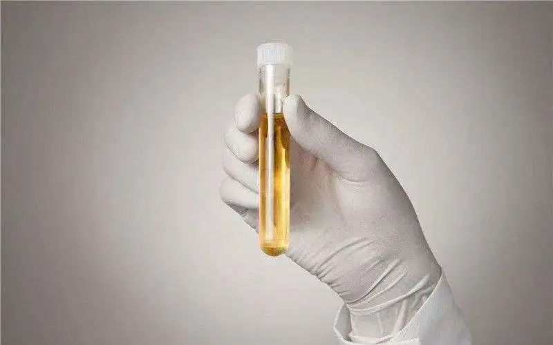 尿蛋白3+多久会形成尿毒症,尿蛋白形成的泡沫多久能消散