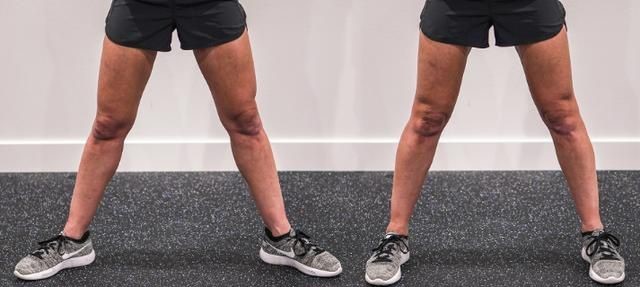 怎么判断深蹲膝盖有没有内扣,深蹲怎么才能不膝盖内扣