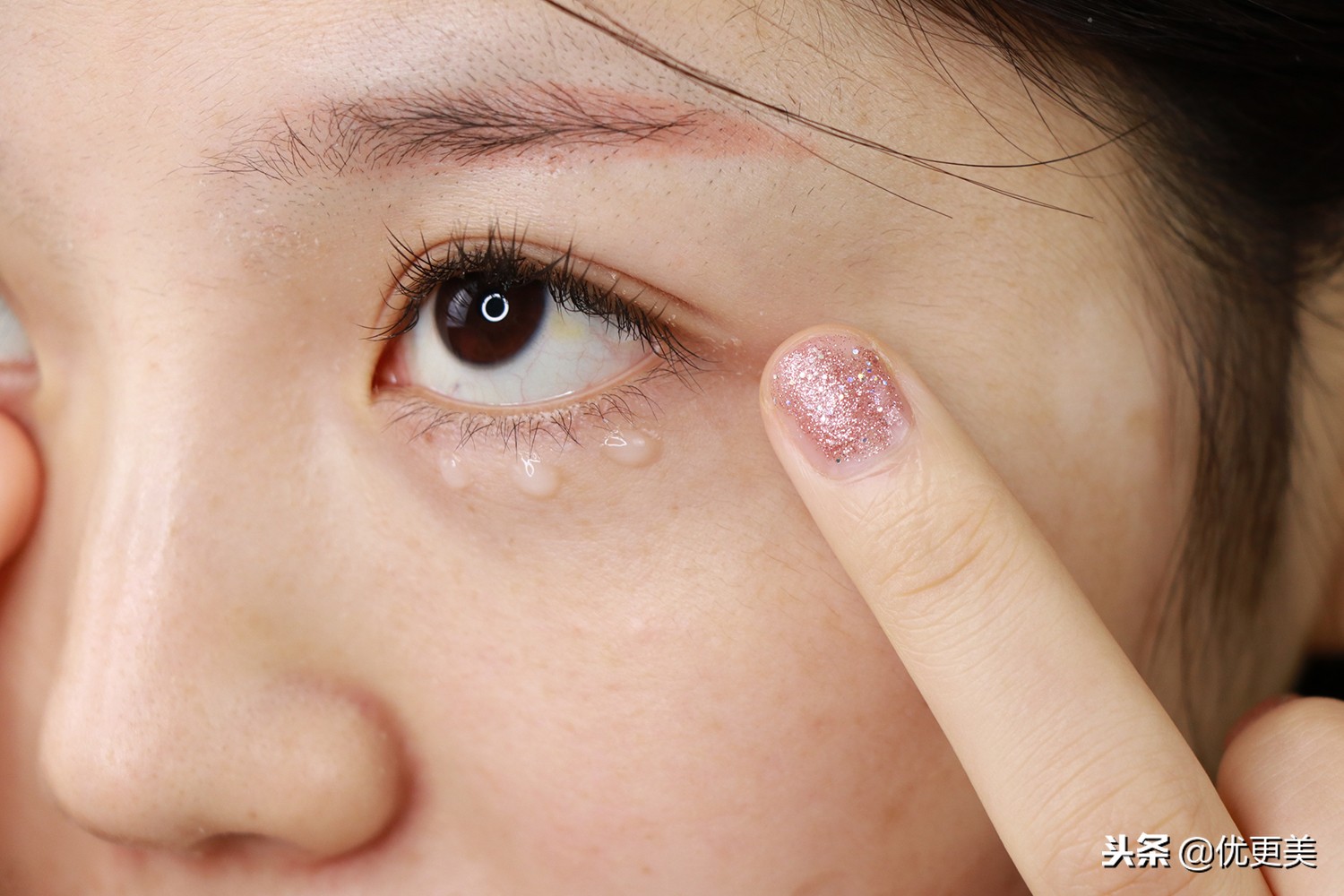 注射式眼部精华，眼周细纹快走开