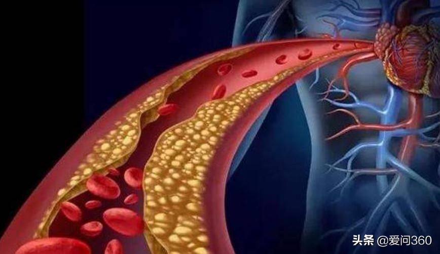 血管没有弹性什么原因该怎么治,血管失去弹性与血虚有关吗