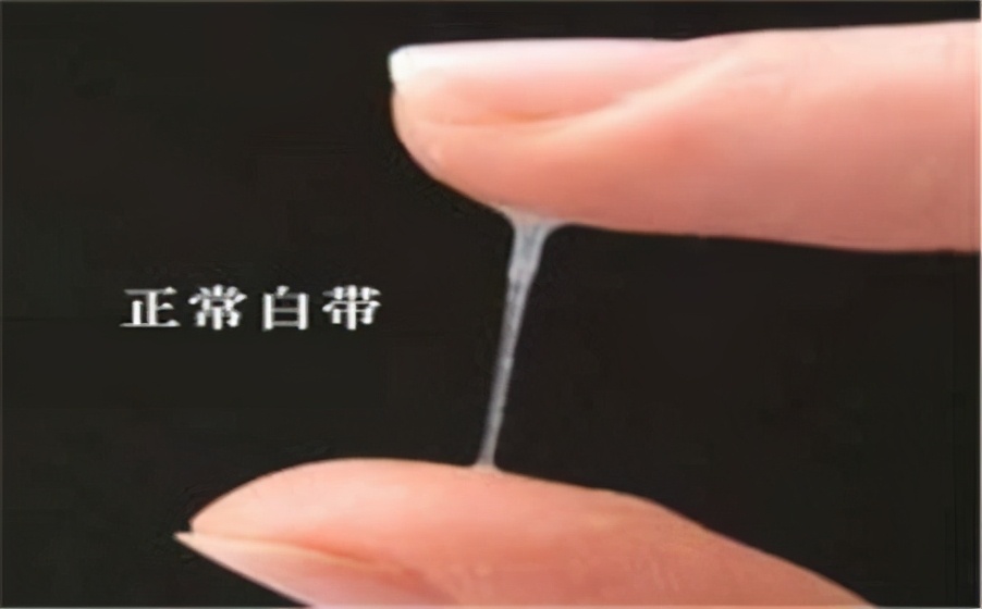 女人妇科瘙痒白带发黄,白带异常瘙痒有臭味