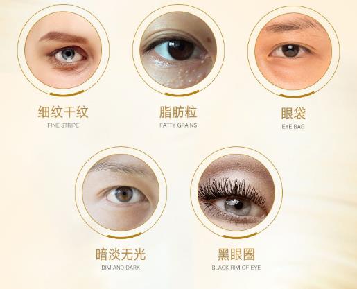 眼睛黑眼圈显老怎么办,眼睛黑眼圈大眼袋怎么消除