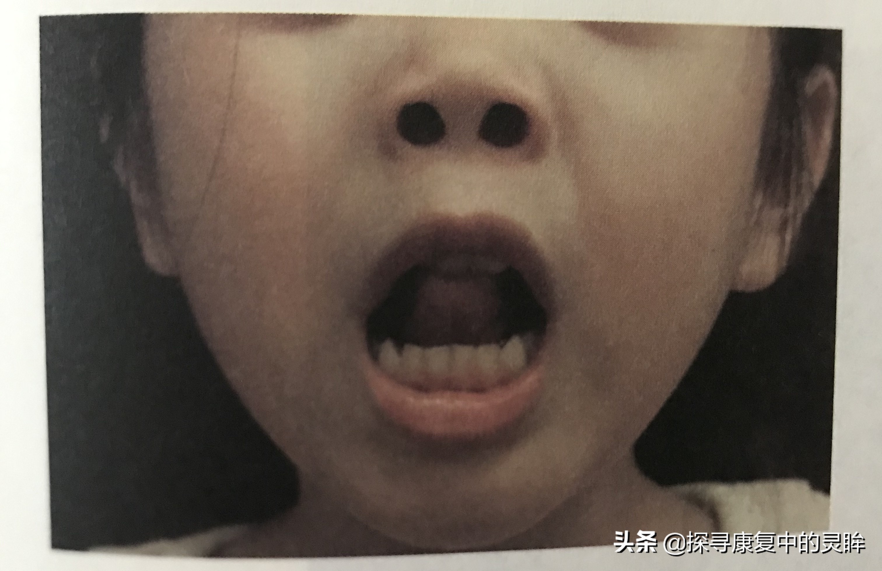 五种口部运动：灵活孩子的樱桃小嘴，让他们说话更清晰（超简单）