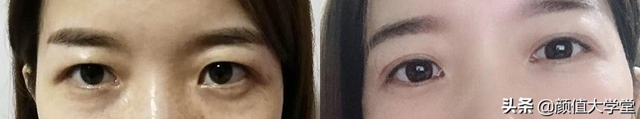 歌手黄霄云整容过吗,黄霄云参加歌手淘汰了谁