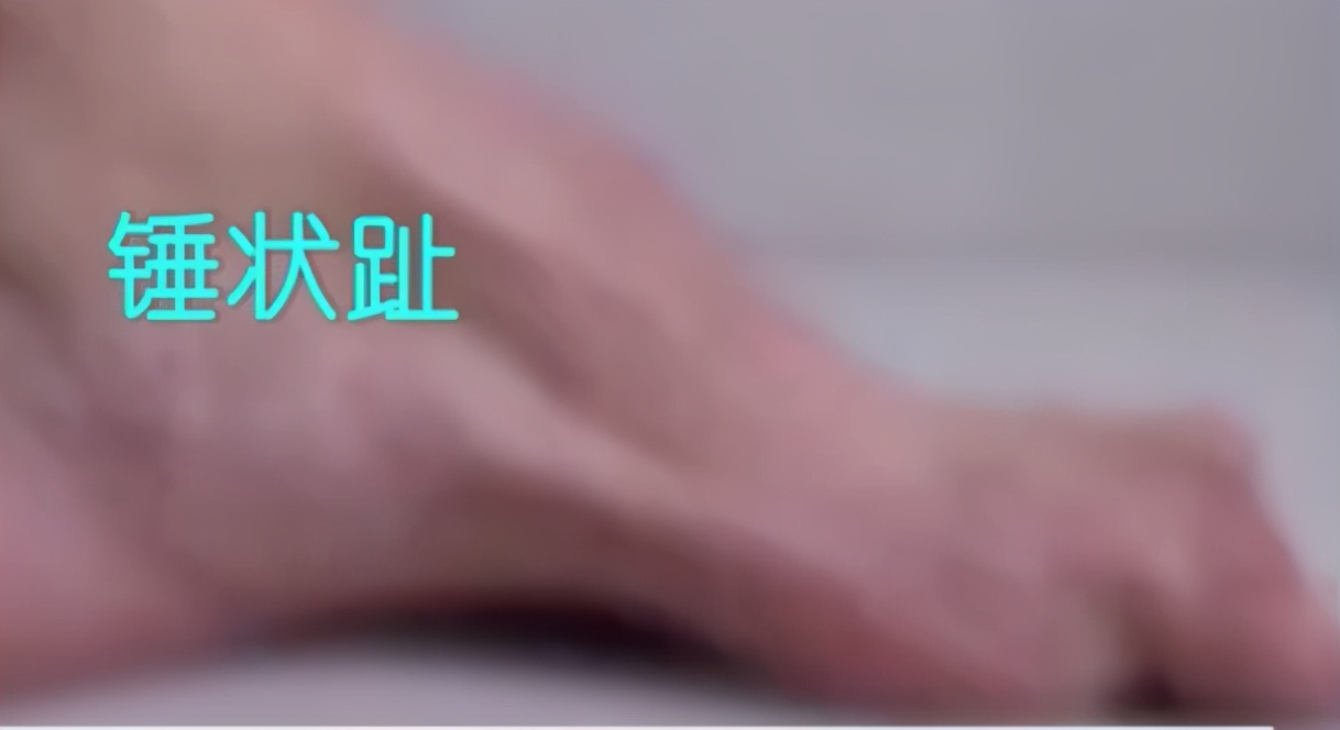 怎样选一款适合自己脚型的鞋,适合大脚骨穿的鞋测评