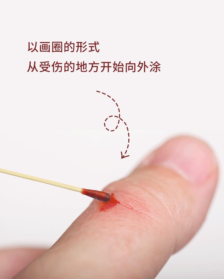 儿童简单外伤的处理方法,如何讲解儿童外伤处理小常识