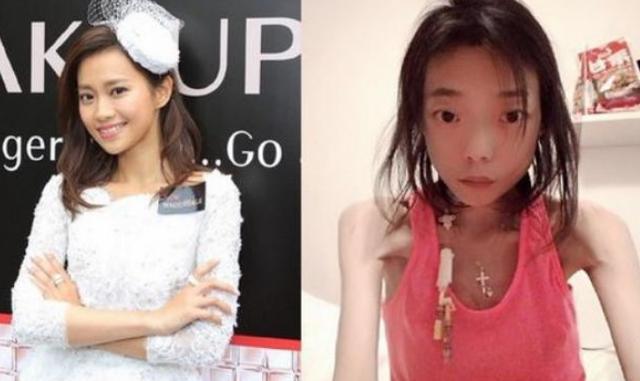 她曾嫁百亿豪门，因吃*肥药减**患病瘫痪被抛弃？如今变成“外星人”