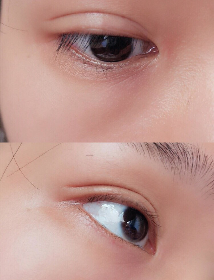 眼霜淡化黑眼圈正确使用方法,眼霜的正确使用方法去除黑眼圈