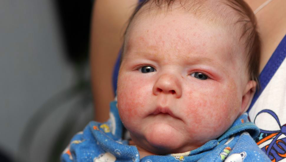 小宝宝皮肤娇弱,冬季宝宝皮肤如何保湿好