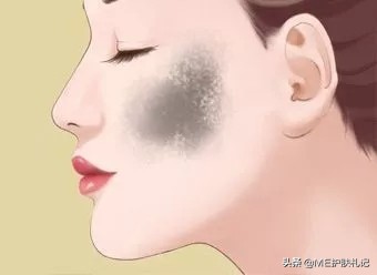 胶原蛋白可以淡化色斑吗,胶原蛋白肽可以淡化色斑吗