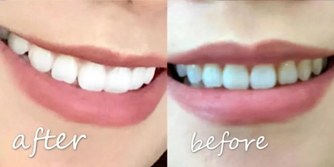 陈乔恩牙膏,陈乔恩推荐的化妆水是什么