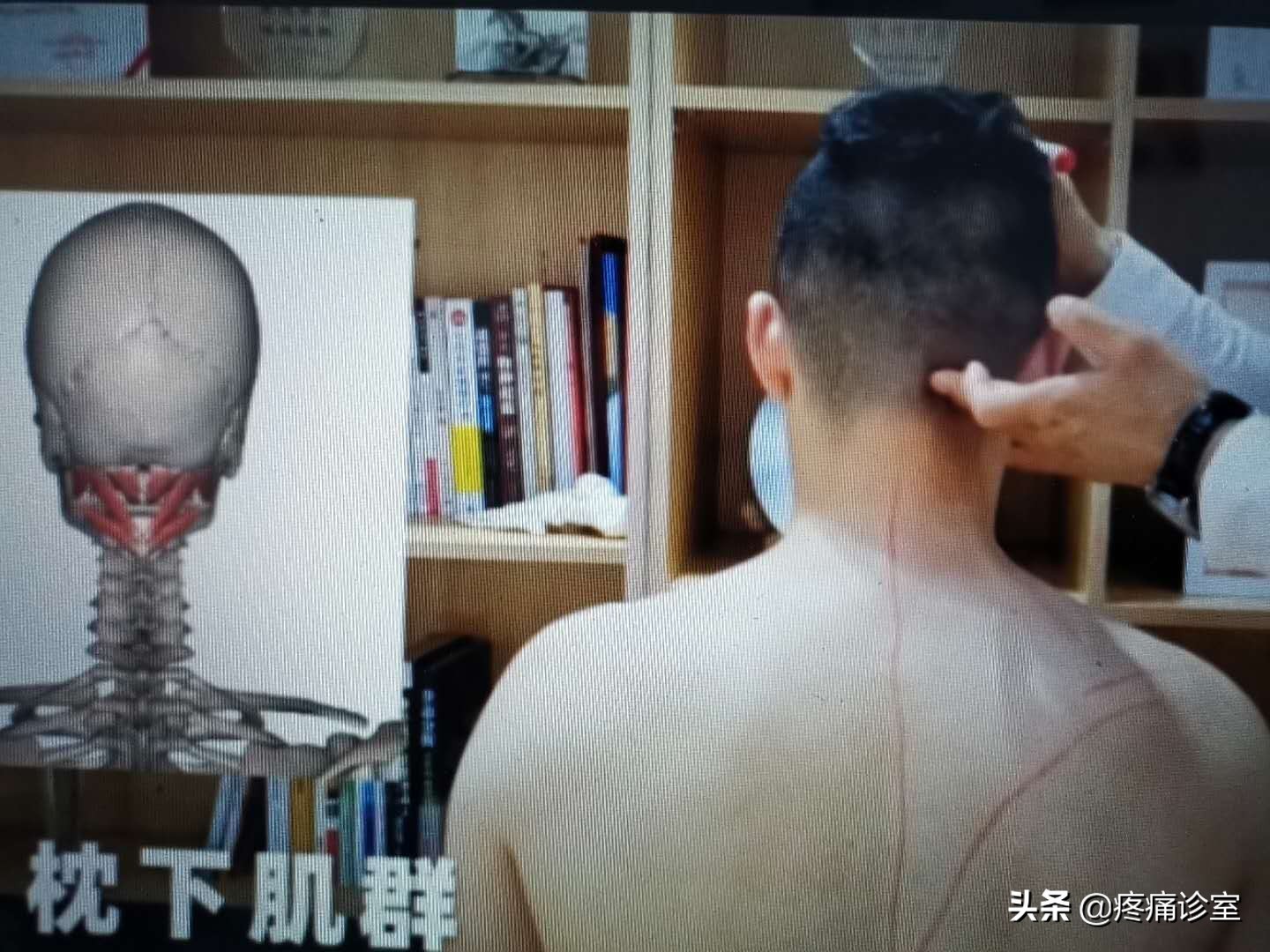 我的偏头痛怎么治好的,我的偏头痛一年多了反复发作