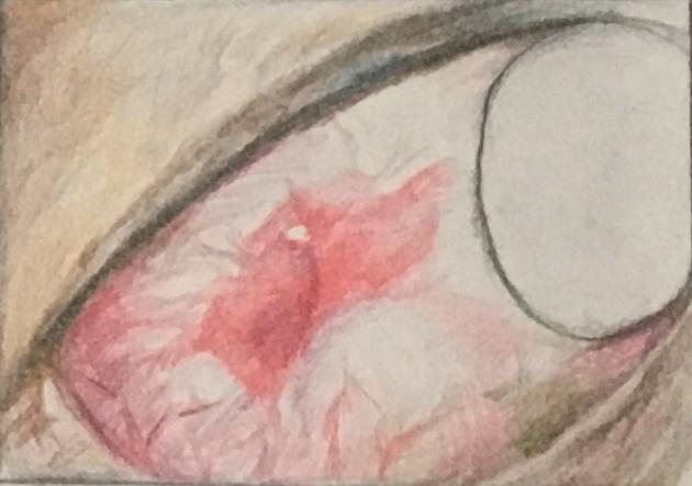 脸红肿掉头发口腔溃疡是什么病,脸长溃疡