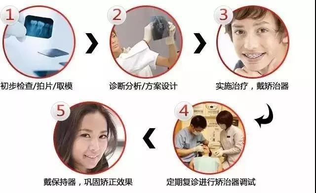 医院整牙矫正一般多少钱,成人整牙矫正需要多少钱