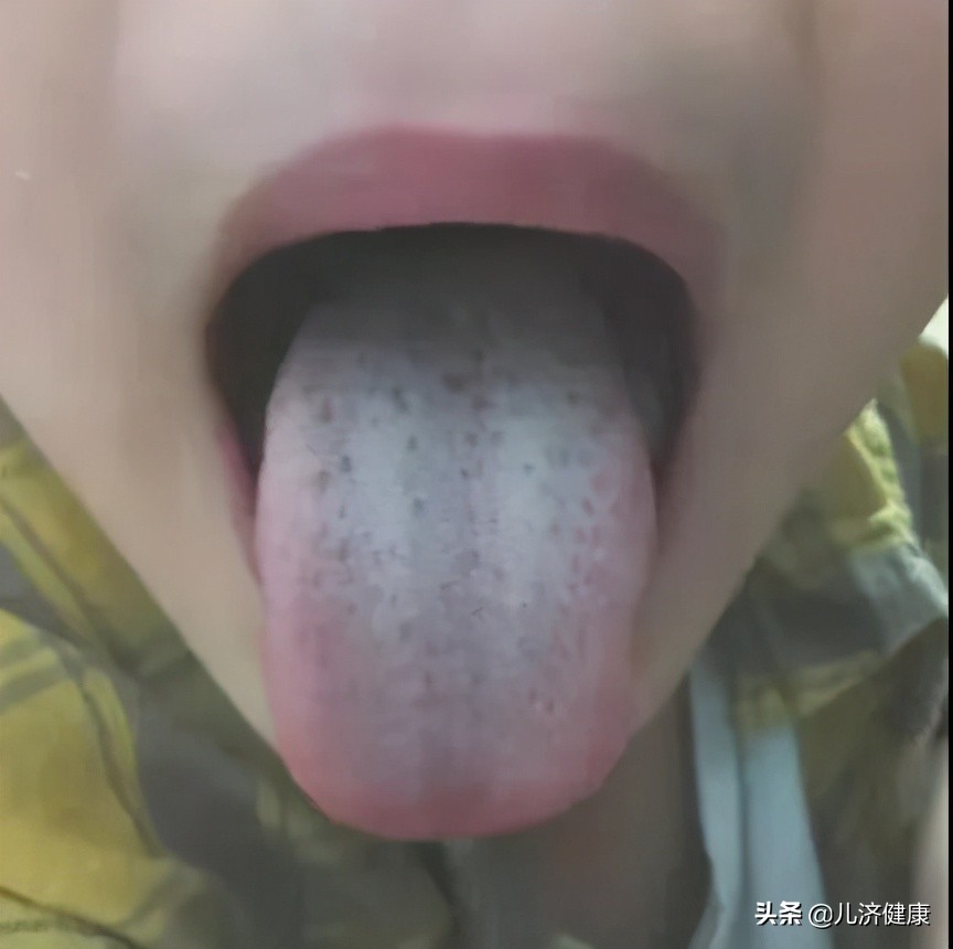 许教授小儿推拿,小孩腹痛拒按压中医辨证