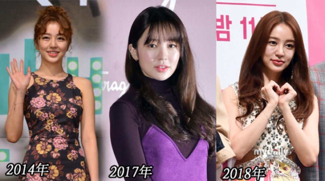 消失3年回归，34岁尹恩惠变苦瓜脸，网友疑问：丰唇了吗？