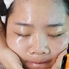 痘坑变黑了增生疤痕凸起怎么去除,红色痘印黑色素沉淀怎么祛除