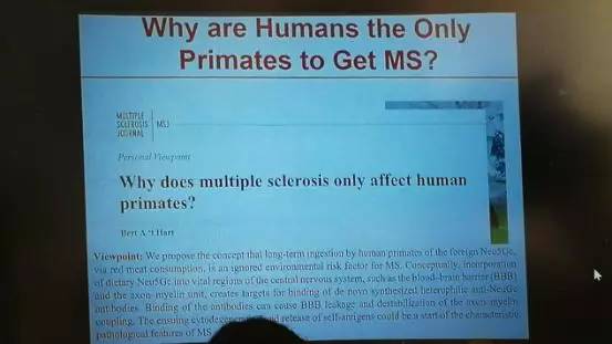 多发性硬化患者分享,多发性硬化的病例分享