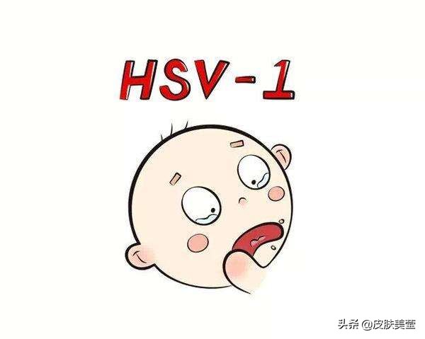 单纯疱疹病毒是什么病,单纯疱疹病毒能怀孕吗