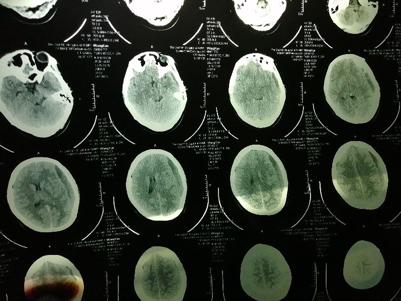 安医附二院生孩子经历,安医二附院生娃