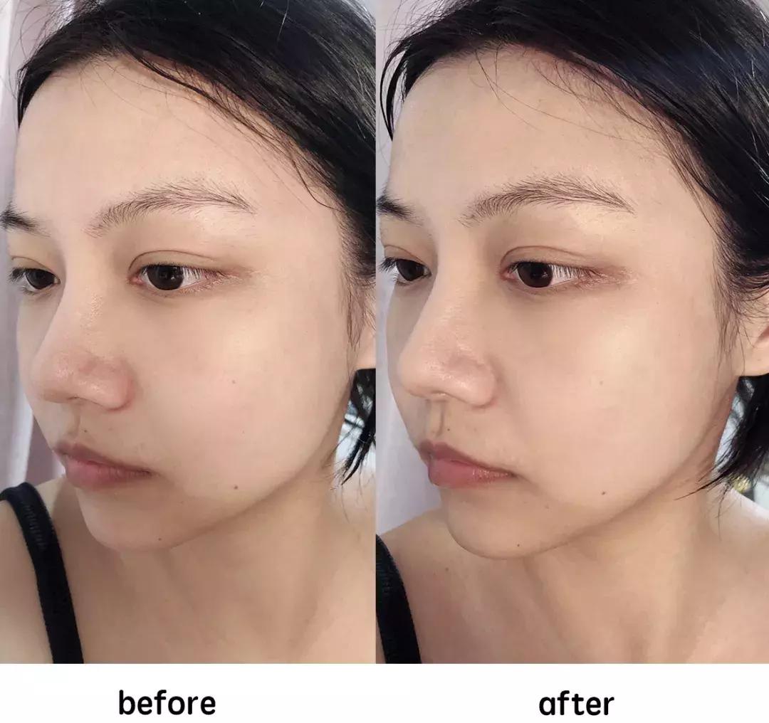 不要被面膜骗了,千万别被美容院忽悠