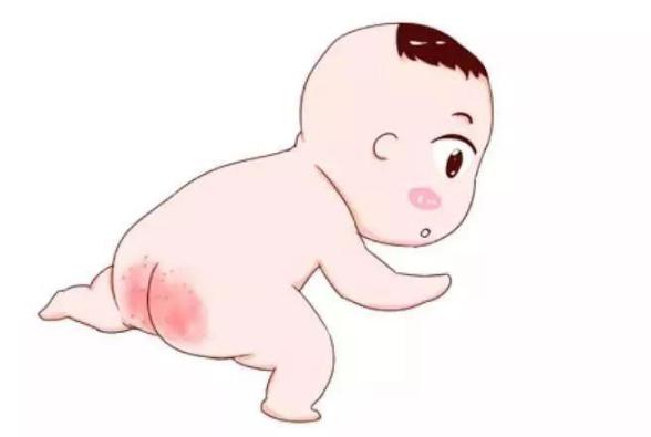 一招轻松搞定宝宝红屁屁,树袋宝宝视频