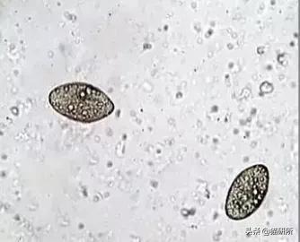 显微镜下的猫屎，竟然和这么多食物都撞脸？