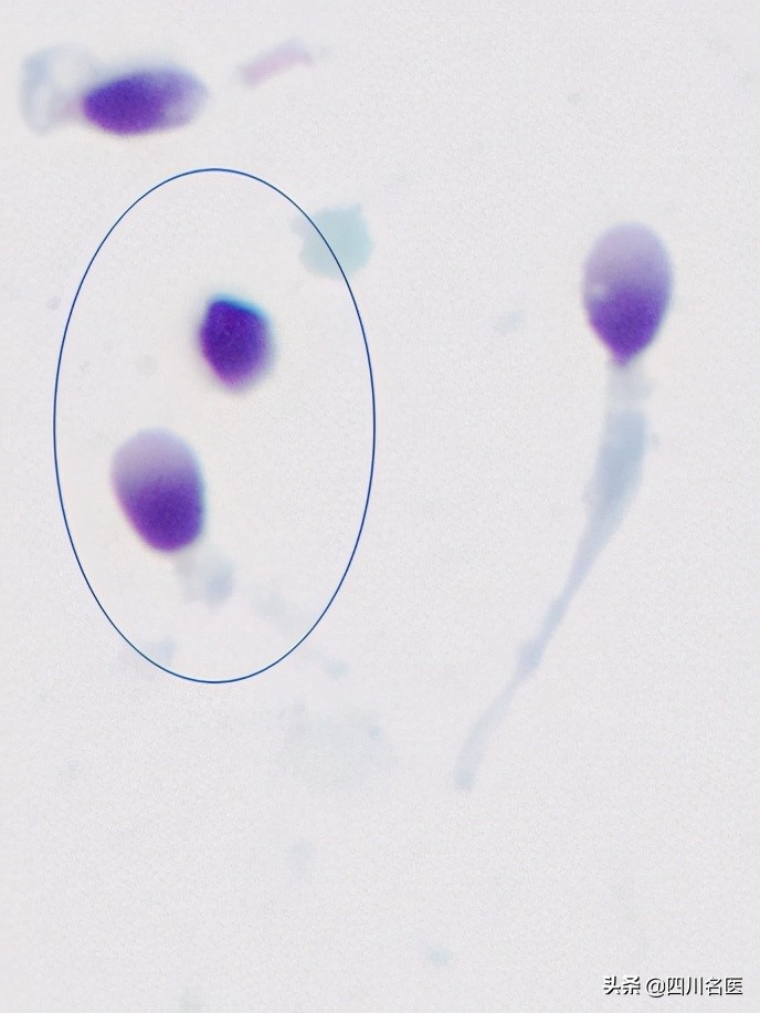 精子是如何产生的百科,精子是不是每天都能生成