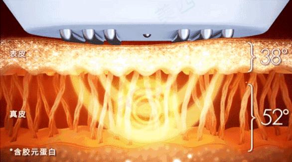 卡戴珊詹娜医美,卡戴珊太后医美