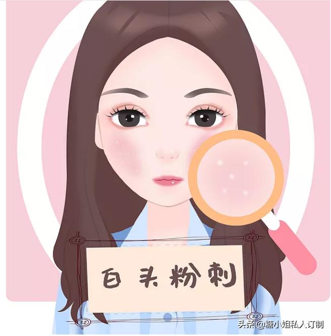 下巴长痘痘可以吃凉血解毒颗粒吗,下巴容易长硬块痘痘