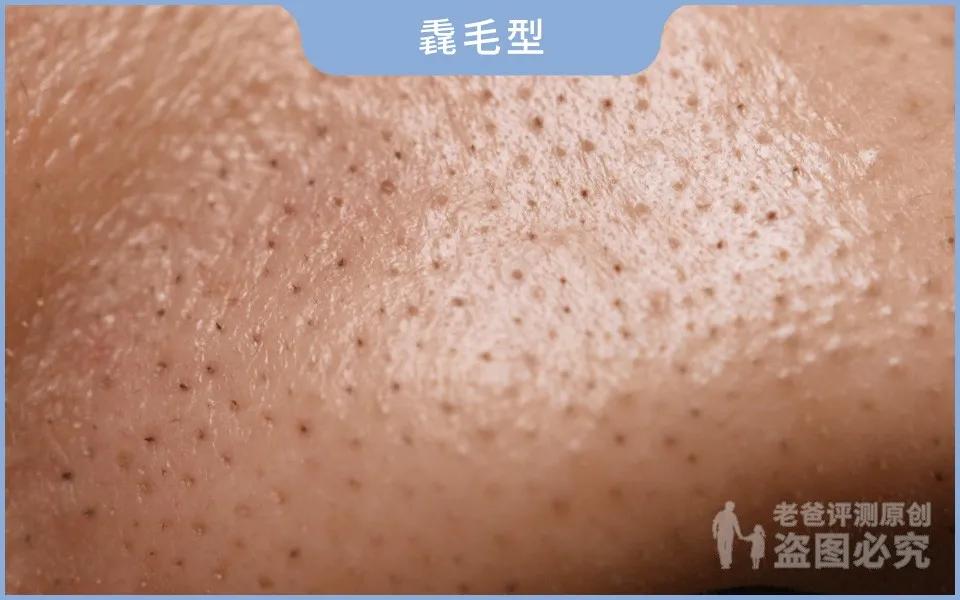 正确科学的去黑头方法一次说清楚,正确的去黑头的方法在这里