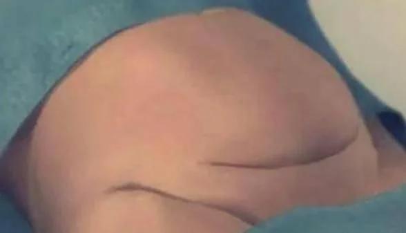 剖腹产仅仅“挨一刀”就完事了？看完四张图，谁说简单和谁急